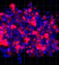 Cells labeled in pink and blue in pancreatic cancer organoid
