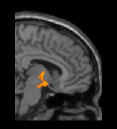 Statistical brain image
