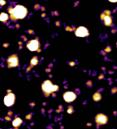 scattered circles, larger white circles are exosomes and smaller purple and yellow structures are exomeres 