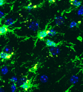 inflammatory microglia stained green and yellow