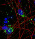 image showing cells stained blue, tau aggregates in green and neuron cytoskeleton in red