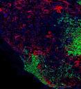 green and red labeled cells in immunofluorescent image