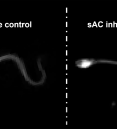 image of human sperm from video showing effects of male contraceptive drug candidate