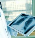 doctor holding tablet with chest x-ray