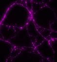 immunofluorescence image of a hippocampal neuron stained for PGK1