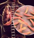 tuberculosis affects the lungs
