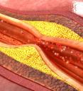 blood artery