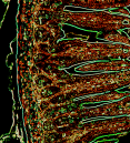 healthy small intestine where immune cells and epithelial cells are highlighted in green and red