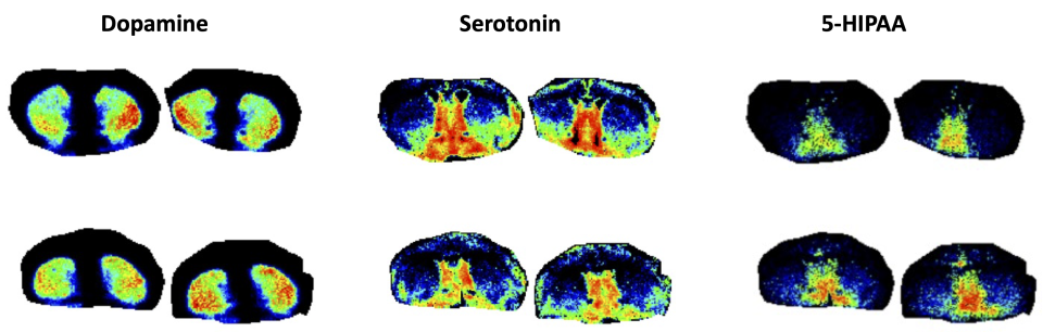 MALDI Mouse Brain neurotransmitters