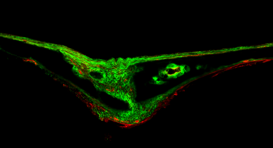 periosteal stem cells appear fluorescent green against black background