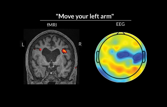Neuroimaging results